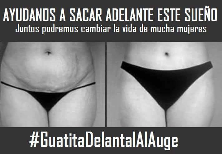 Ley guatita delantal 2