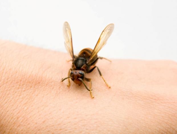 ¡Qué dolor! Actriz de Hollywood se dejó picar por abejas