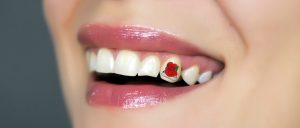 ¿Tatuajes en los dientes? Conoce la nueva tendencia en Estados Unidos, Japón y Europa