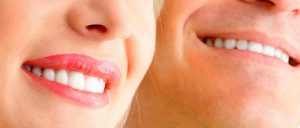 ¿Obsesionada con que tus dientes sean blancos? Ojo, porque podrías sufrir de blancorexia