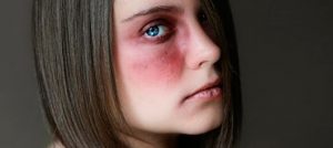 Famosa cantante subió a sus redes sociales una foto donde sale golpeada