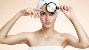 Descubre cuáles son las causas del acné en distintas partes del rostro