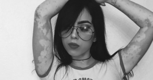 Esta mujer decidió transformar su enfermedad en una obra de arte