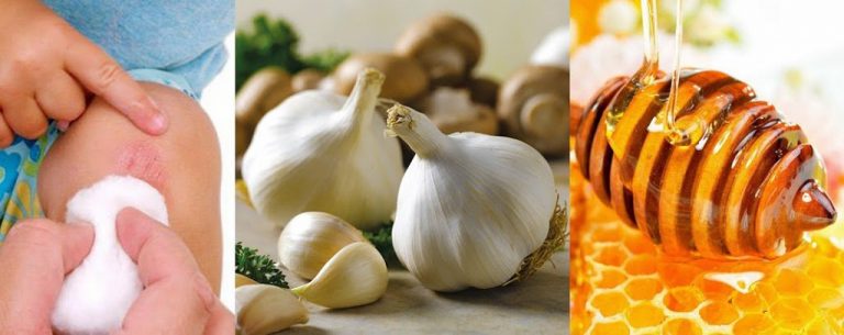 Descubre los mejores antisépticos naturales y sus usos