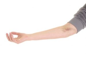 ¿Tienes moretones? Aprende a eliminarlos naturalmente