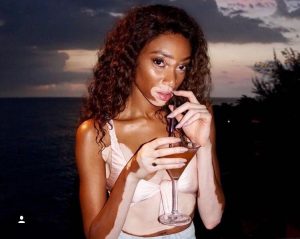 Modelo posa desnuda para compartir inspirador mensaje sobre el vitiligo