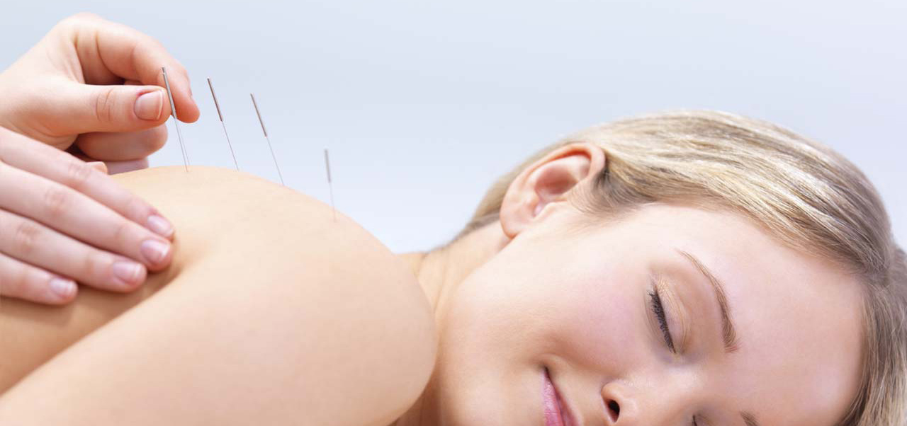 Punción seca: Conoce esta efectiva técnica para relajar la musculatura