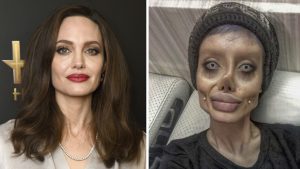 Esta es la verdad tras las impactantes fotos de joven que quería "parecerse" a Angelina Jolie