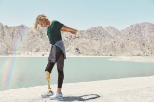 La triste realidad actual de la modelo que perdió un pierna por usar tampón