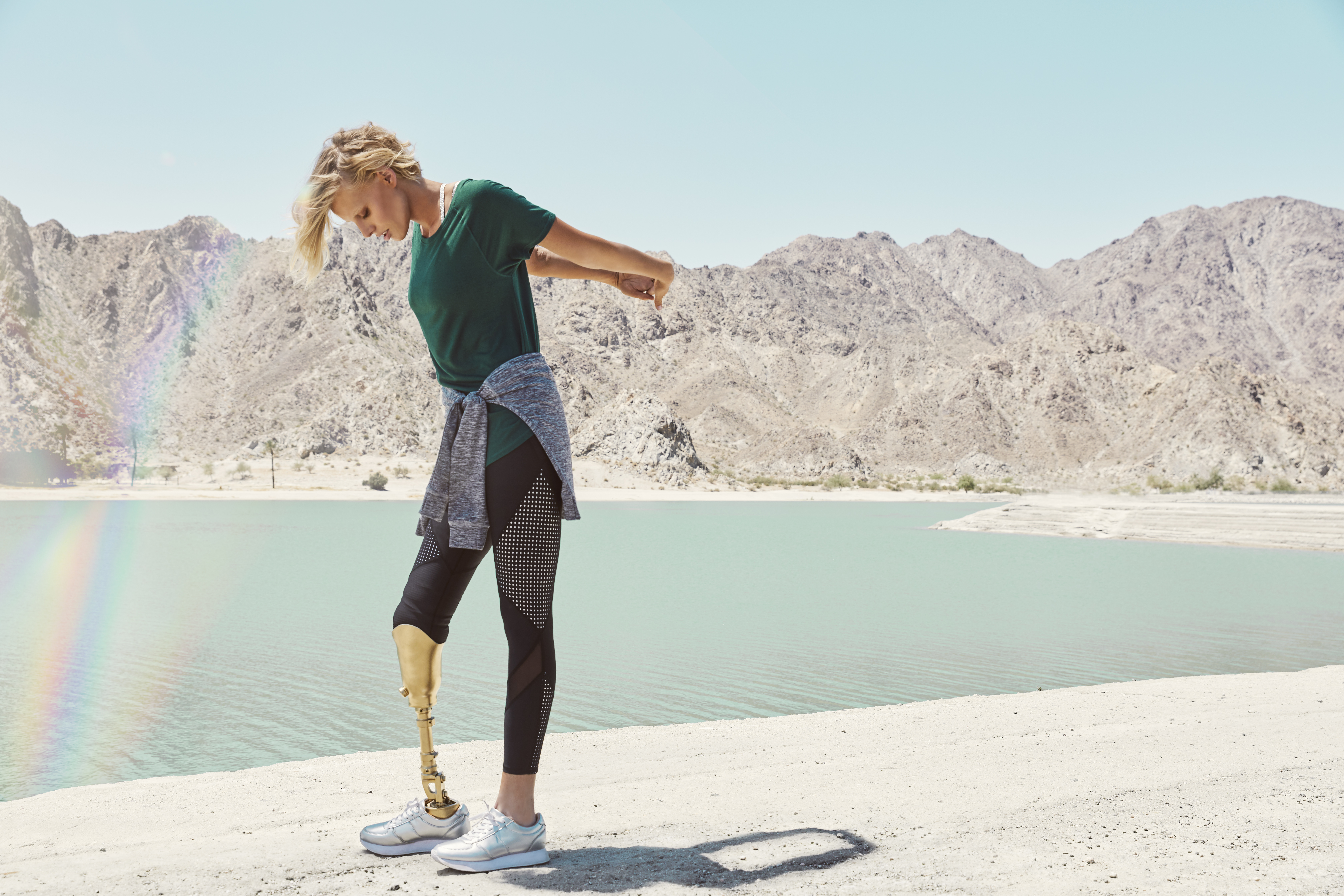 La triste realidad actual de la modelo que perdió un pierna por usar tampón