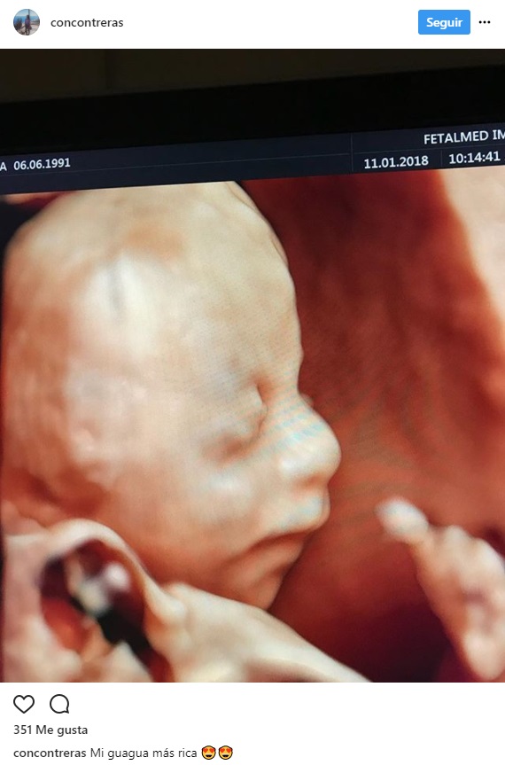 Constanza Contreras instagram