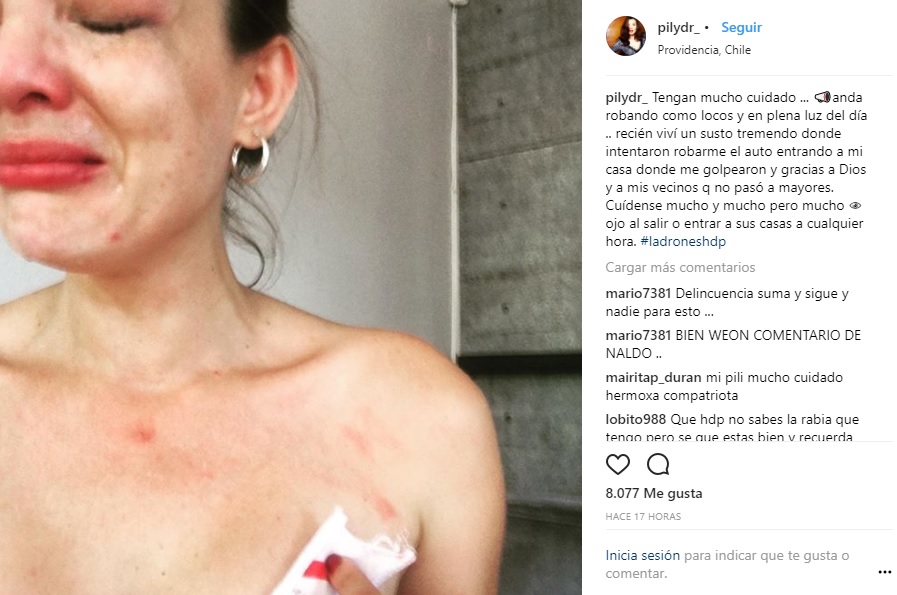 felicidad ir al trabajo Cuadrante Pilar Ruiz impacta con dramática fotografía tras sufrir intento de  portonazo — FMDOS