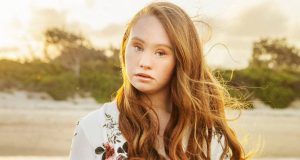 Famosa modelo con Síndrome de Down revoluciona las redes sociales con su nueva figura