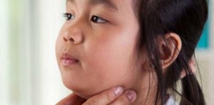 Alerta en el Ministerio de Salud por aumento en brote de paperas