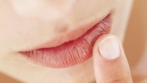 Cuida tus labios del invierno: Conoce cómo puedes protegerlos