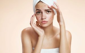 ¡Al fin! Crean vacuna que elimina el acné