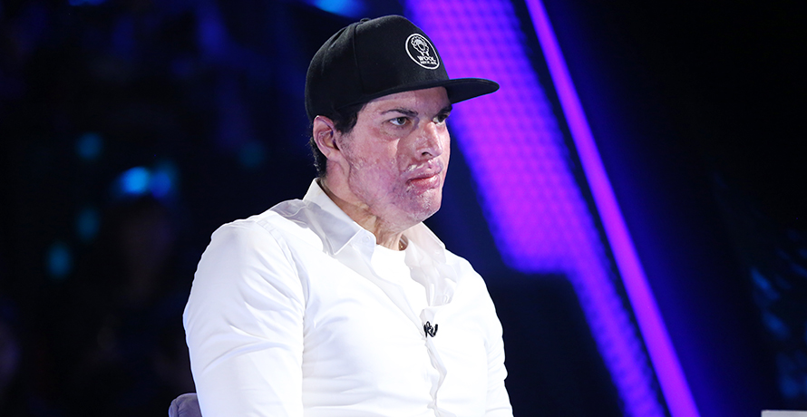 ¿Maquillado? Ignacio Lastra responde a las críticas tras compartir fotografía