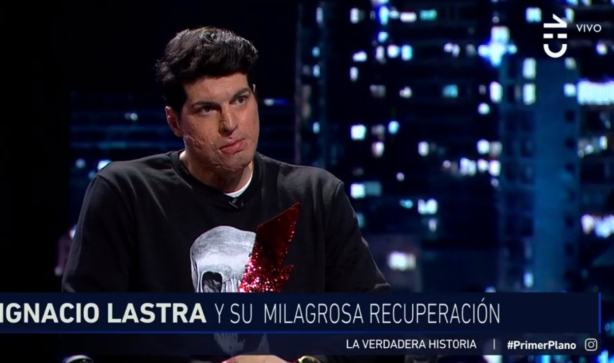 A un año de la tragedia: Ignacio Lastra reapareció en televisión en Primer Plano
