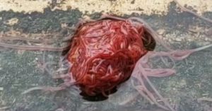 Expertos aclaran qué es la extraña "criatura" similar a un cerebro que vive en alcantarillas