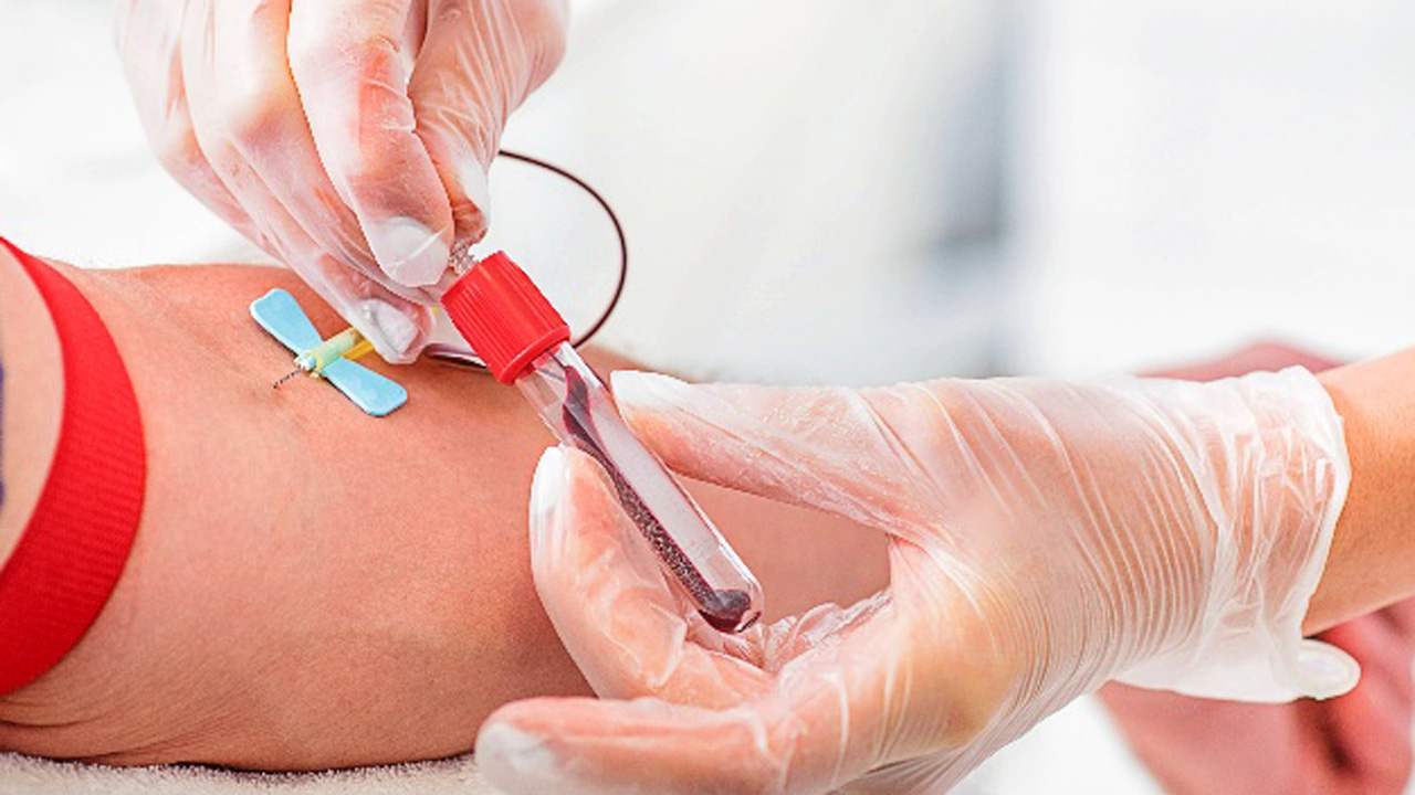 Chile es uno de los 10 países con mayor aumento de VIH