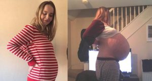 No estaba embarazada: mujer es operada para sacarle un quiste de 26 kilos