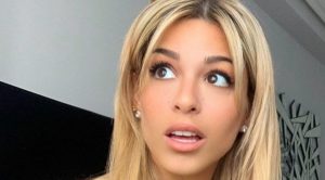 Oriana Marzoli muestra sin tapujos los resultados del ácido hialurónico en su rostro