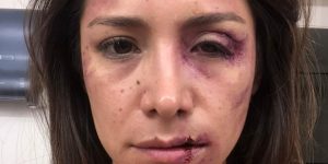 Loreto Aravena advierte: "Lo que se viene para Josefa es peor que la muerte"