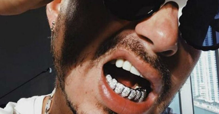 Video: J Balvin sufre tratando de quitarse los dientes falsos