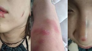 Pareja de lesbianas denunció brutal ataque homofóbico en Barrio Bellavista