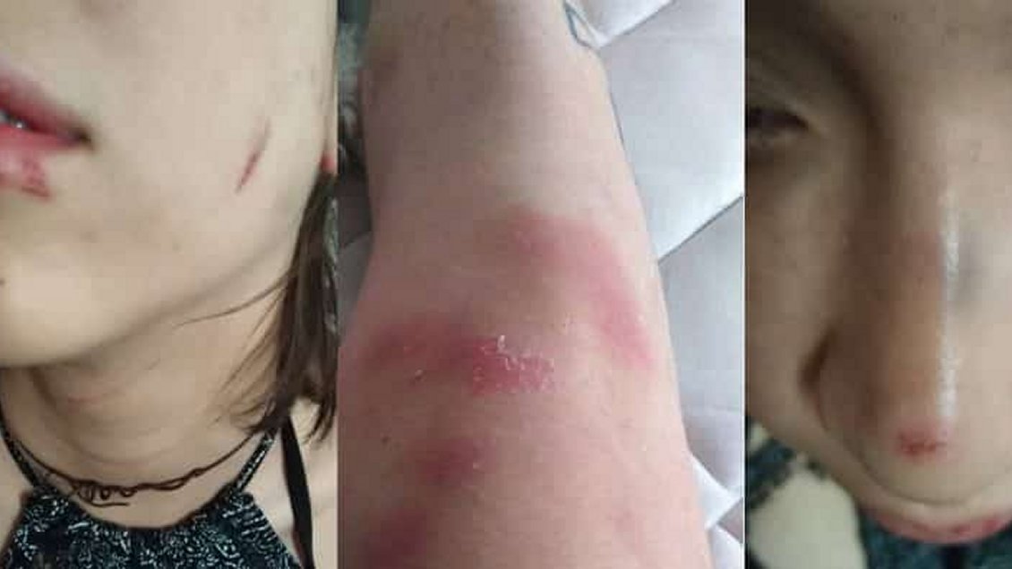 Pareja de lesbianas denunció brutal ataque homofóbico en Barrio Bellavista