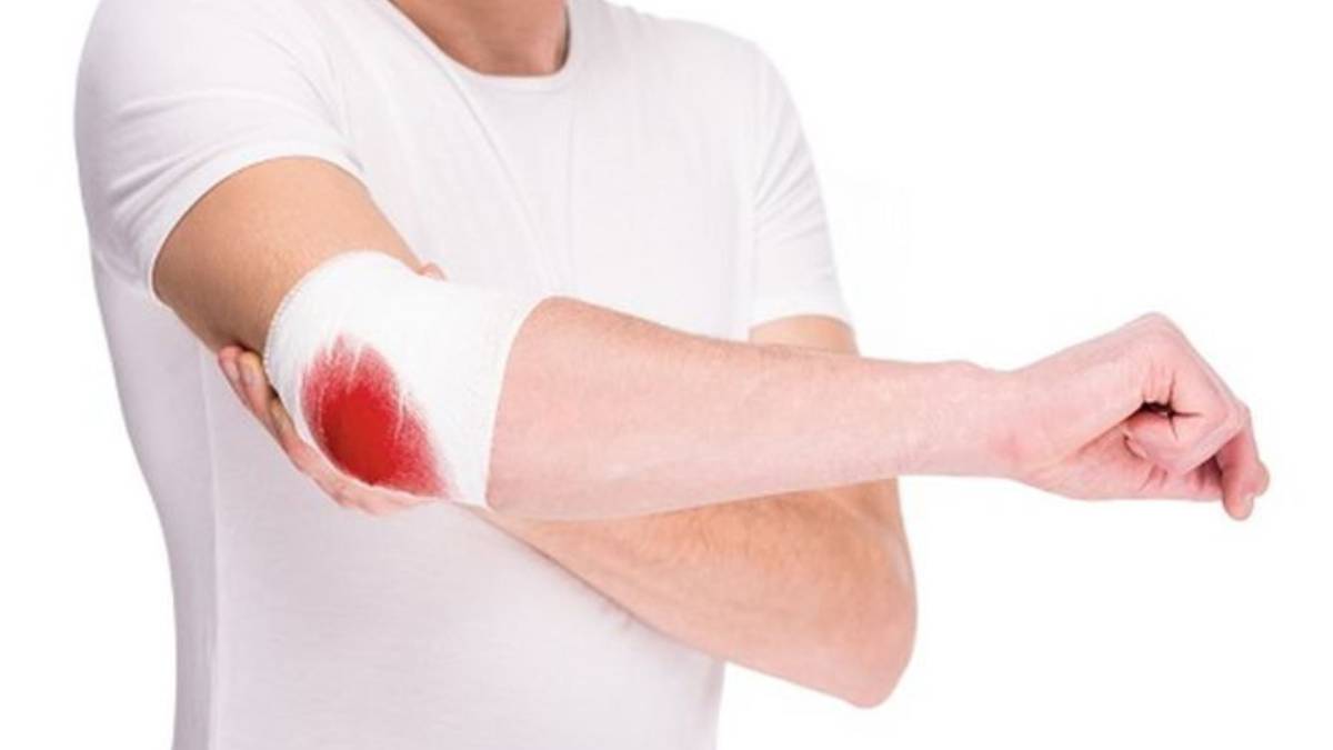 Día mundial de la hemolifia: ¿Qué es y en qué consiste su tratamiento?