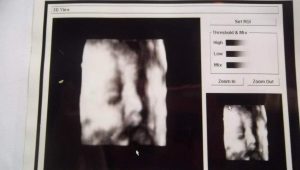 La defensa del ginecólogo que entregó la misma ecografía 3D a decenas de mujeres