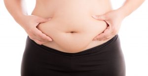 Conoce los requisitos para acceder a una abdominoplastía gratuita