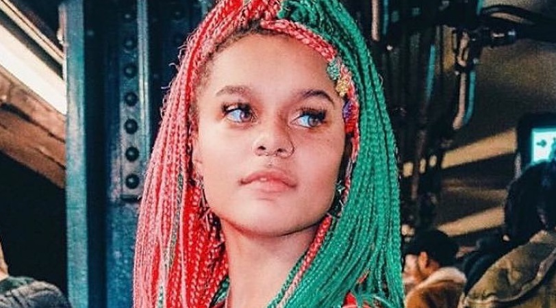 Joven quedó calva tras hacerse una decoloración casera que transmitió en Instagram