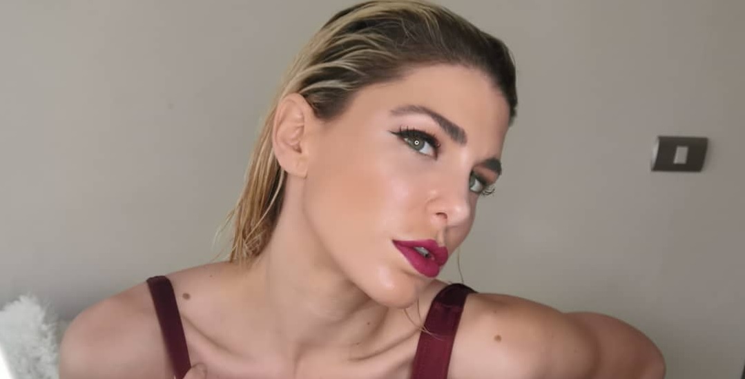 Wilma González respondió a las críticas por su rinoplastía: "Me da pena"