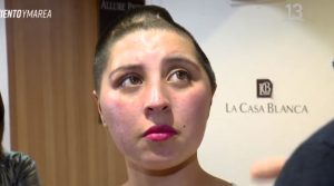 Novia de "Contra viento y marea" mostró el resultado de su operación en "Bienvenidos"