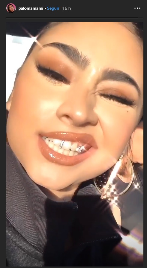 paloma luce su dentadura