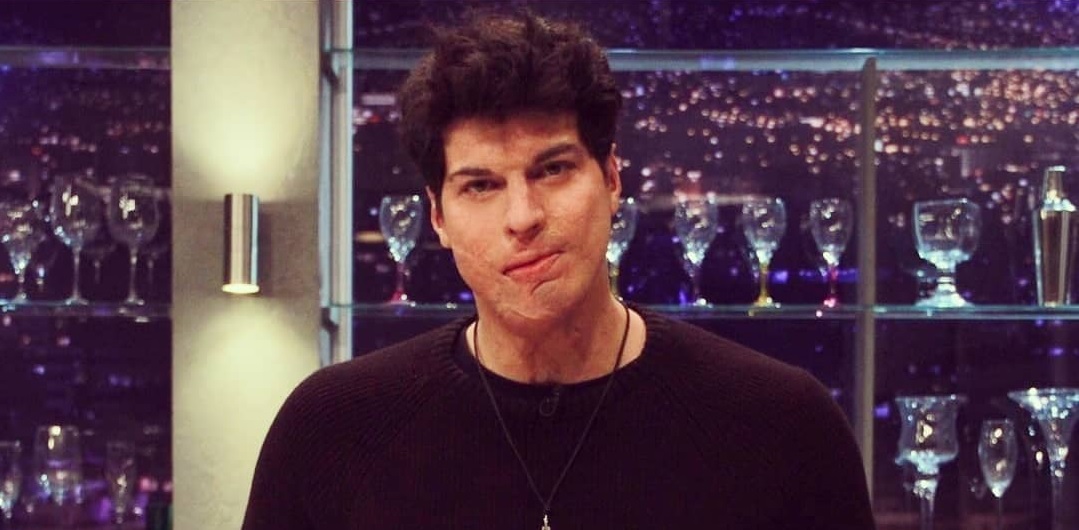 Ignacio Lastra respondió a quienes lo critican por perjudicar su piel fumando