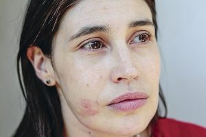 Actriz María Paz Grandjean tras disparo a su rostro:  "Lo que pido es justicia y saber quién me disparó"