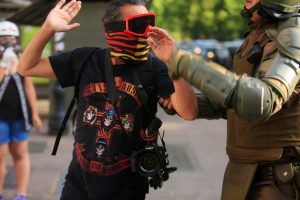 A 352 personas asciende la cifra de personas con heridas oculares tras el estallido social