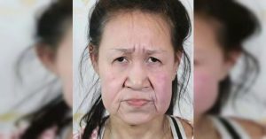 Niña china que parecía anciana fue sometida a cirugía estética y luce irreconocible