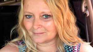 "Me arruino el rostro": El drama de mujer que se hizo microblanding fallido en sus cejas