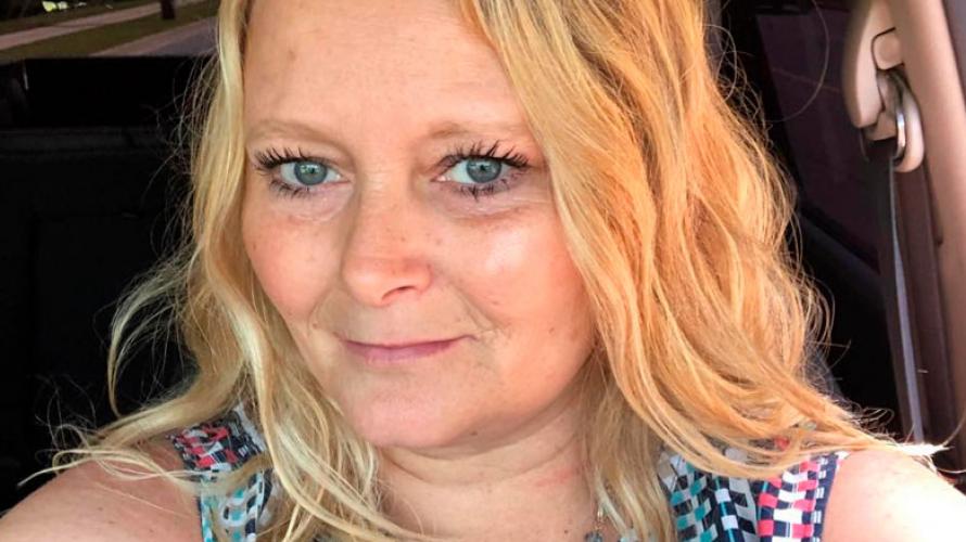 "Me arruino el rostro": El drama de mujer que se hizo microblanding fallido en sus cejas