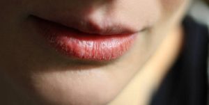 ¿Labios secos? Estos son los consejos de los expertos para hidratarlos