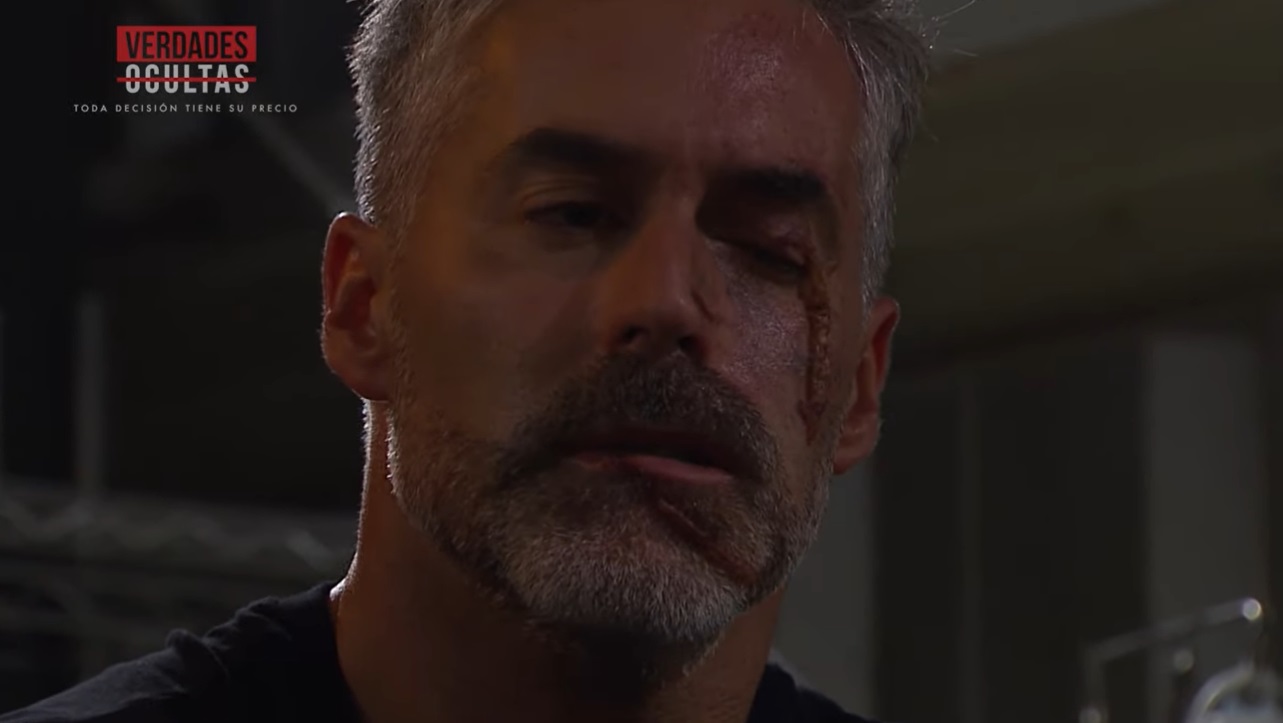 Carlos Díaz explicó por qué Leonardo reapareció en "Verdades ocultas" con cicatrices en su rostro