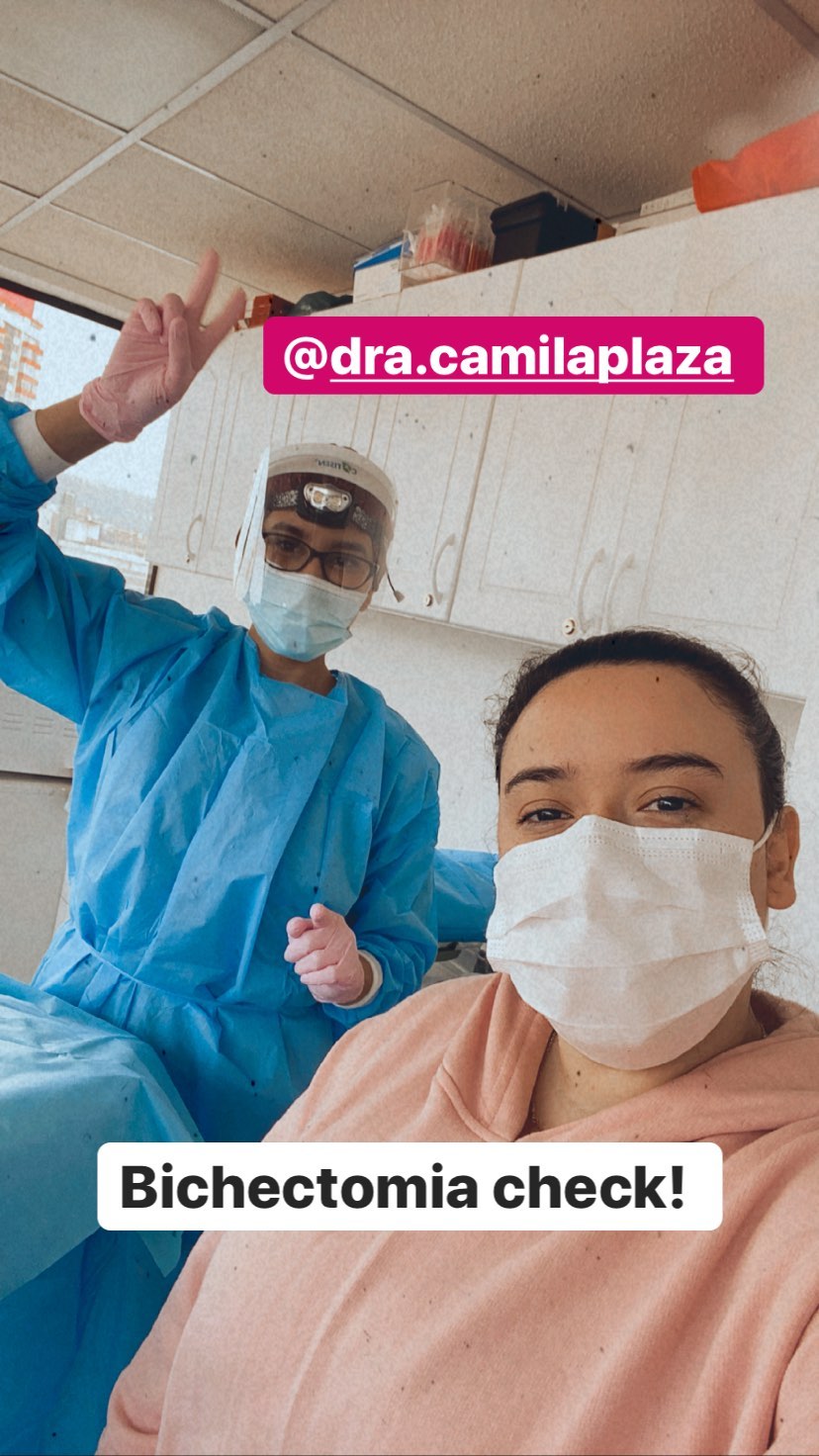 la bichectomia que se hizo christell