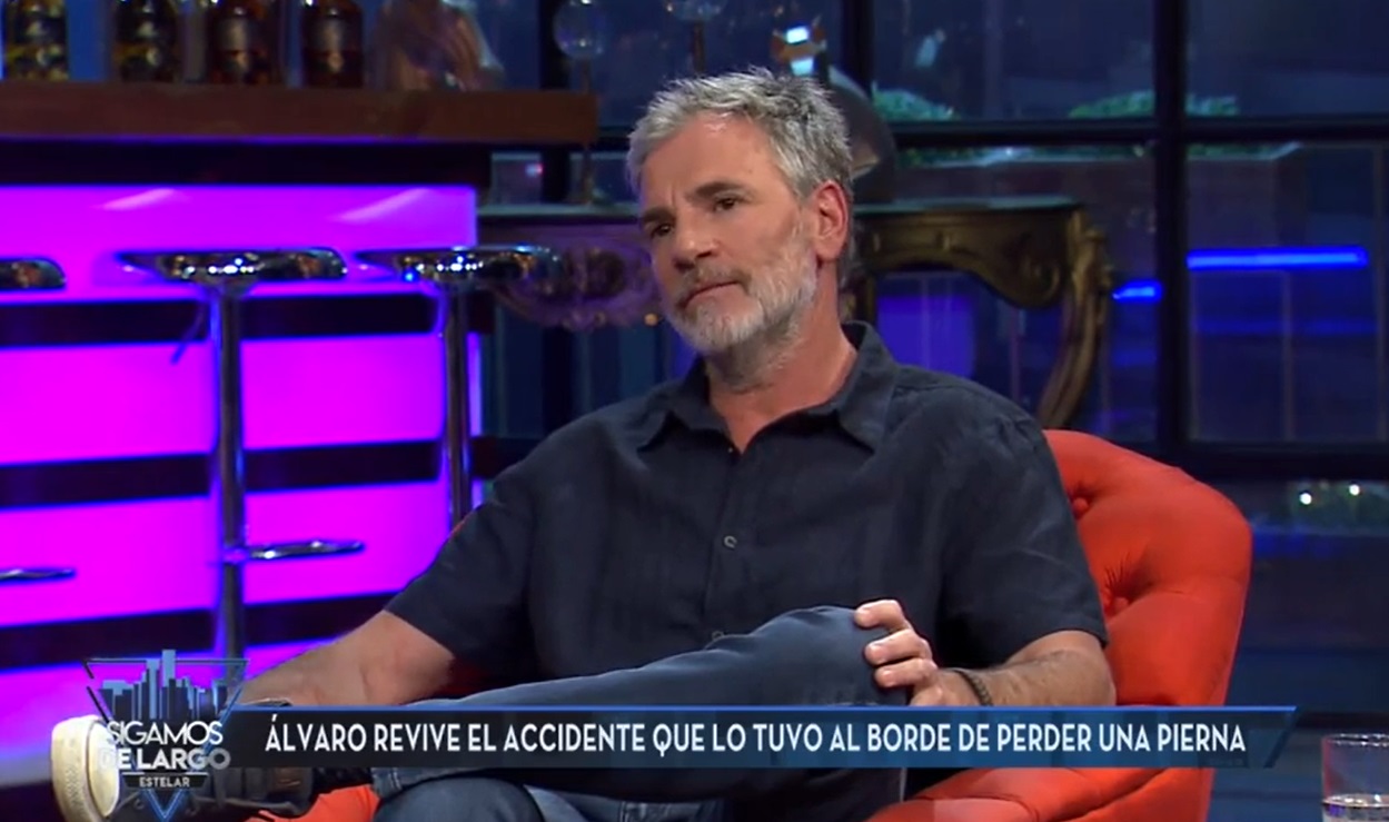 el actor contó el terrible accidente que vivió de niño