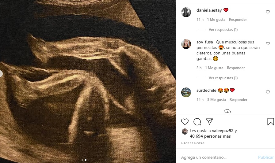 la actriz mostró una tierna ecografía de sus mellizos