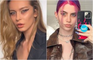 las ojeras son la moda en tiktok