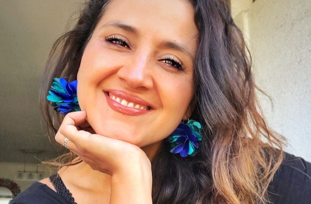 Pamela Leiva confiesa que padece alopecia: estos son los tratamientos que ha probado